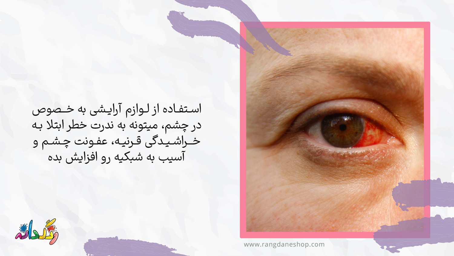 خراشیدگی قرنیه چشم یکی از عوارض استفاده مداوم از لوازم ارایشی بر روی چشم