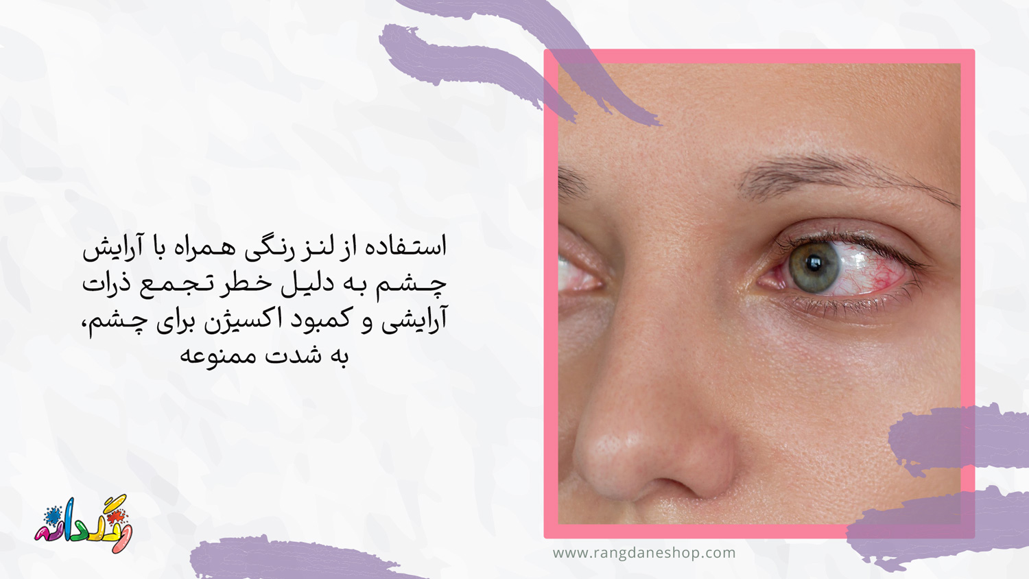 خطرات استفاده از لنزهای چشم رنگی یکی از عوارض استفاده مداوم از لوازم ارایشی بر روی چشم