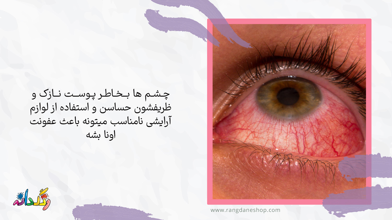 بروز عفونت‌های چشمی یکی از عوارض استفاده مداوم از لوازم ارایشی بر روی پوست